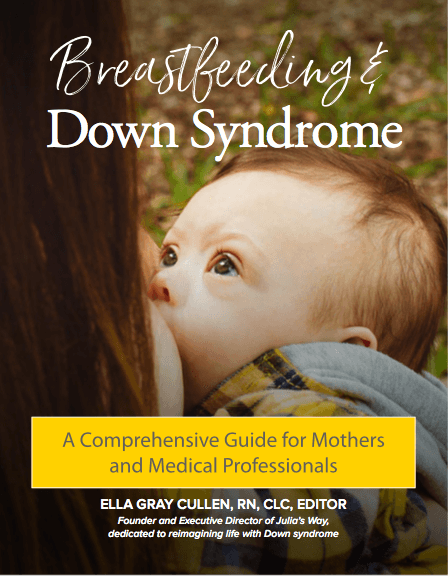 Breastfeeding and Down syndrome cover image
